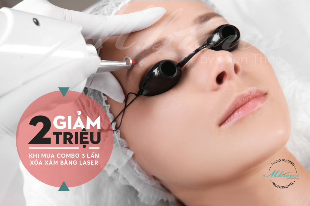 ƯU ĐÃI HẤP DẪN DỊCH VỤ XÓA XĂM CHÂN MÀY BẰNG LASER